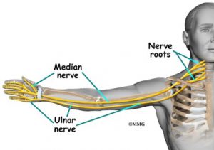 Figure: After exiting the spinal column, the "pinched" root forms an ulnar nerve, and pain and numbness spread along it to the little fingers. Due to this, the problem in the spine can be manifested in, for example, numbness of the little finger.