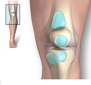 Image: Knee bursae that can be inflamed. Although treatment is relatively successful, it can cause great knee pain and difficulty walking for years, before arriving at the right diagnosis.