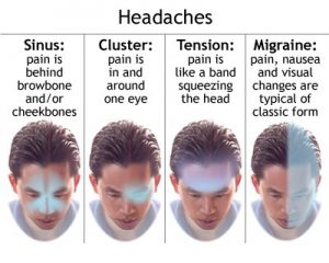 Different types of a headache